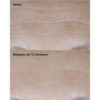 Clinique Smart Clinical Repair SPF30 Wrinkle Correcting Cream  50ml-217043 Clinique Smart Clinical Repair SPF30 Wrinkle Correcting Cream  50ml-217043 4